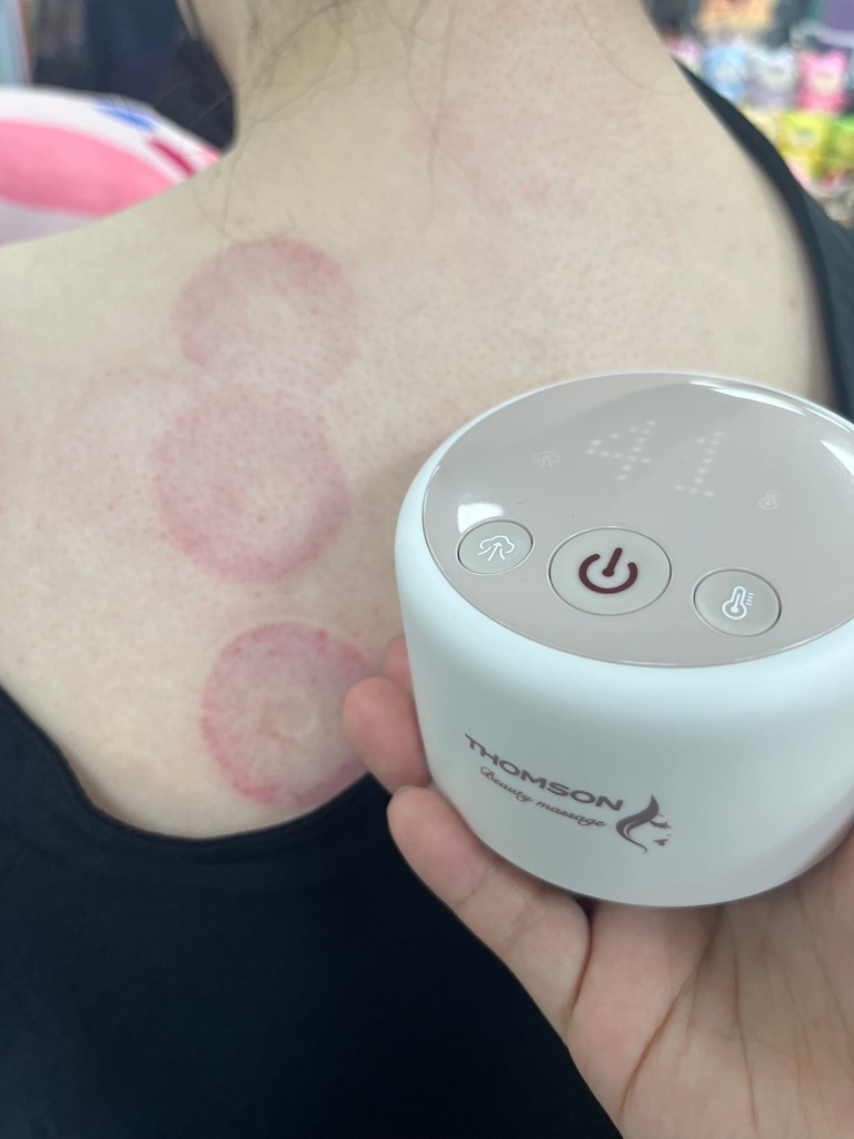 【THOMSON】真空刮痧拔罐儀🔴溫養好氣色