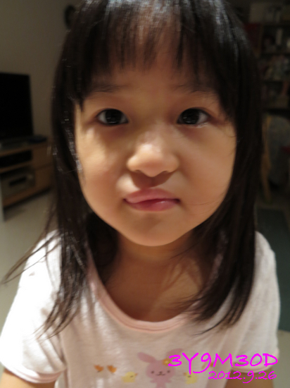 3Y09M30D-過敏-01 3Y09M30D-過敏-01