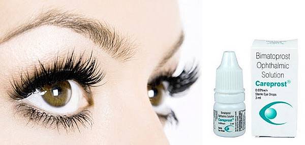 Eyelash-with_-careprost.jpg