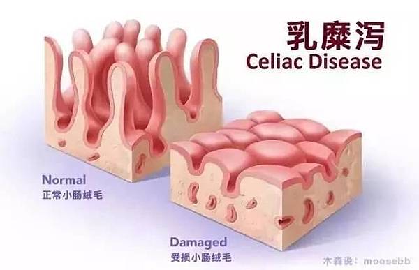 為什麼消化不良呢 凱熙的好食生活 痞客邦 為什麼消化不良呢 凱熙的好食生活 痞客邦