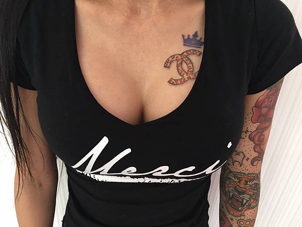 果凍矽膠隆乳 案例 術後 meimei.jpg 果凍矽膠隆乳 案例 術後 meimei.JPG.jpg