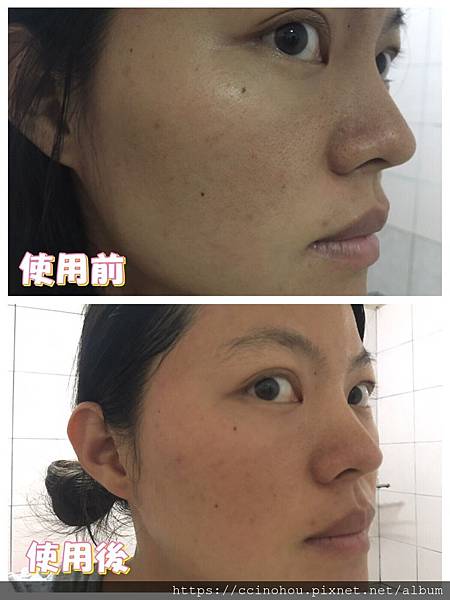 女人知己試用大隊,trilogy,紐西蘭天然有機品牌,trilogy逆齡抗老有機玫瑰果油,抗老,天然有機認證,玫瑰果油,保濕滋潤,天然萃取植物精華,淡化細紋,Rosapene專利抗老成分