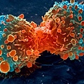 Lung_Cancer_Cell.jpg