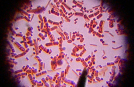 美國 出現超級病菌crkp肺炎克雷伯菌 死亡率達35 圖 普諾的匪夷所思 痞客邦