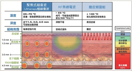 極線音波拉提5.jpg