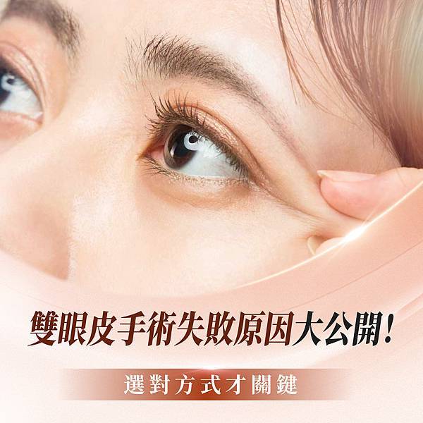 雙眼皮手術失敗原因大公開！選對方式才關鍵_張至德醫師.jpg