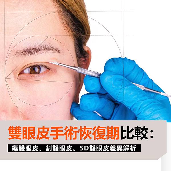 雙眼皮手術恢復期比較：縫雙眼皮、割雙眼皮、5D雙眼皮差異解析.jpg