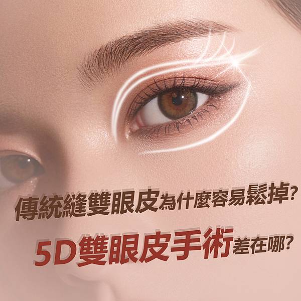 張至德醫師5D雙眼皮_01.jpg