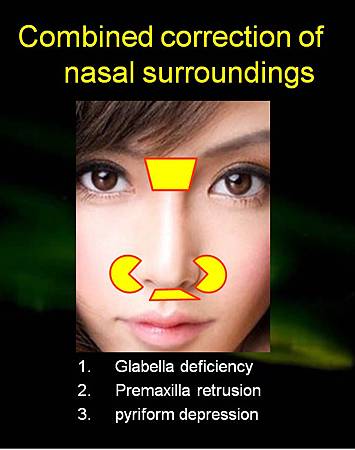 nasal surroudings