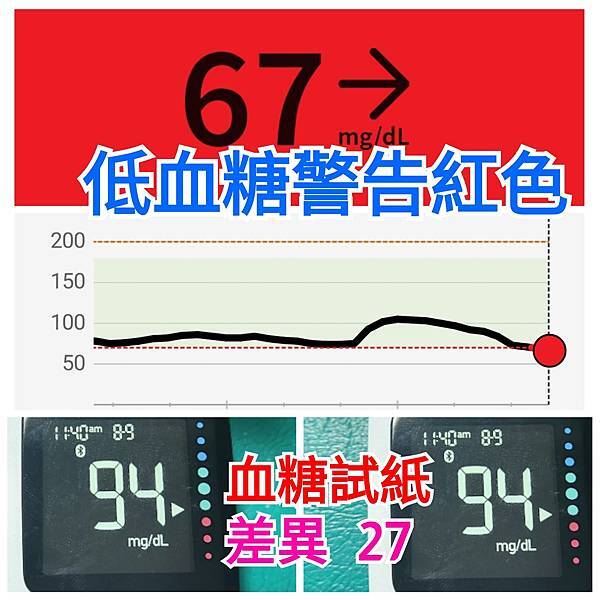 於三個月內四次安裝連續血糖監測(CGM)之心得