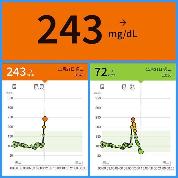 於三個月內四次安裝連續血糖監測(CGM)之心得