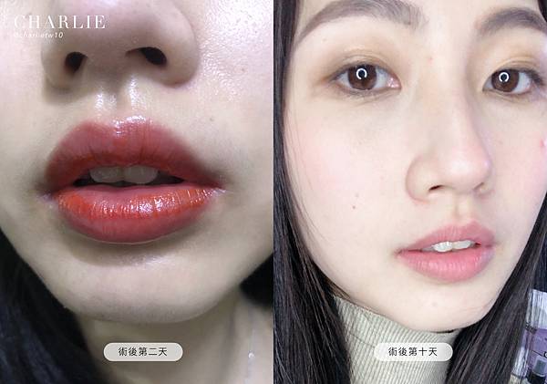 20210314-2.jpg 20210314-2.jpg