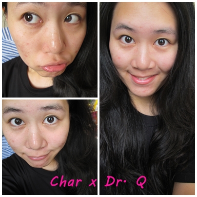 Char x Dr. Q Day 1