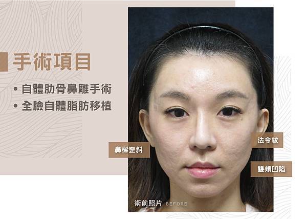 20190325歪鼻_2.jpg 20190325歪鼻_2.jpg