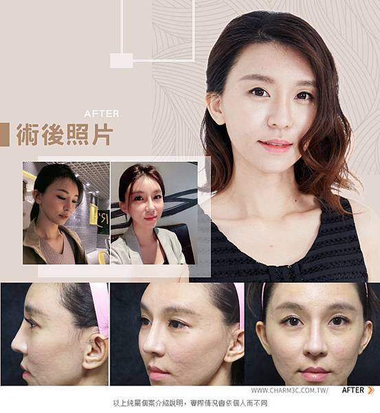 20190325歪鼻_5.jpg 20190325歪鼻_5.jpg
