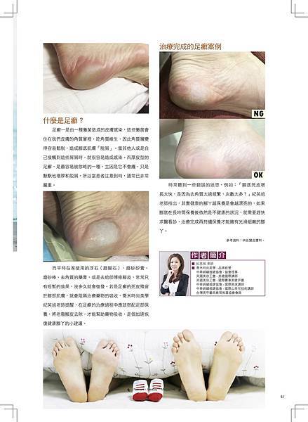 1除不完的腳底皮? 1除不完的腳底皮?