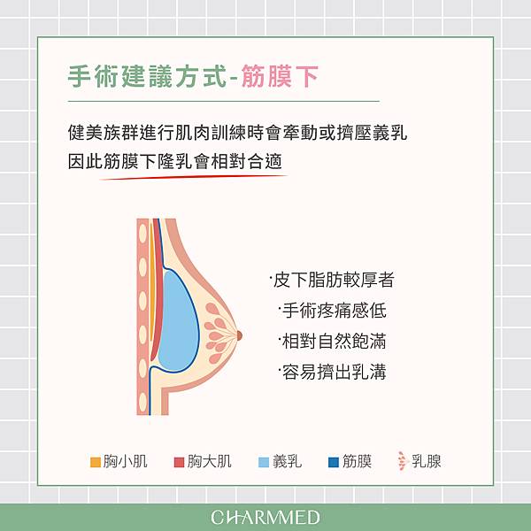 健身族群隆乳方式建議