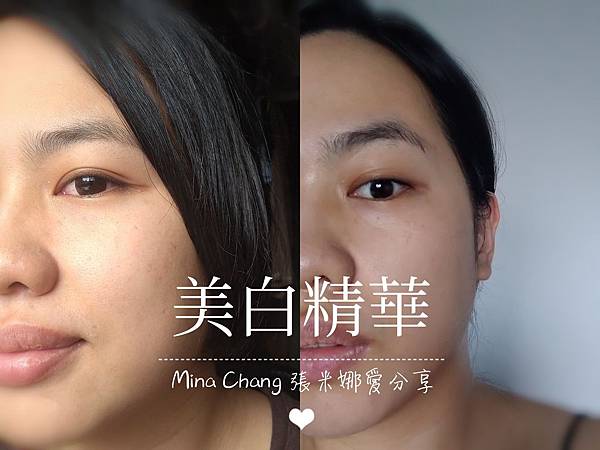 【保養】迷思只要白?美白精華分享!დ變透亮的秘密