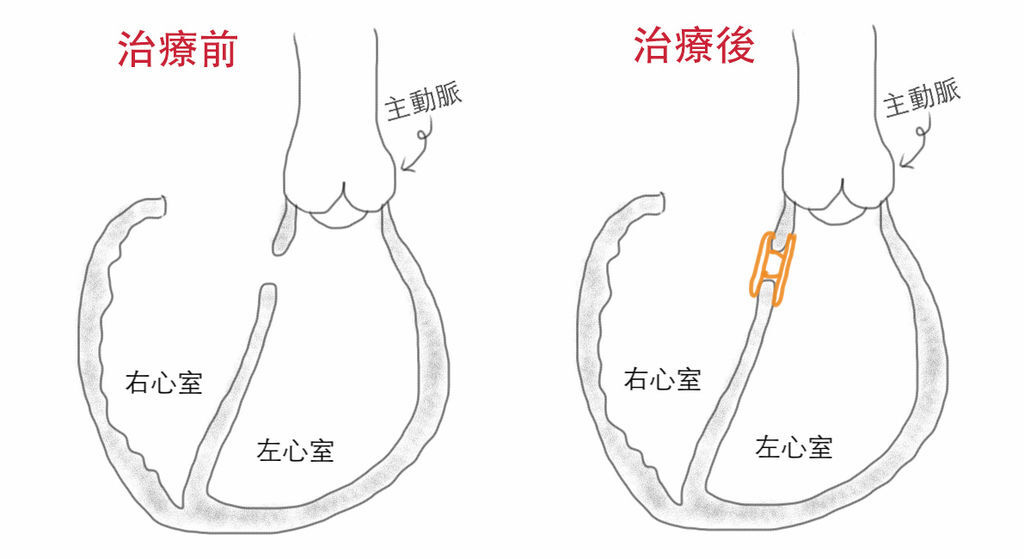 before and after