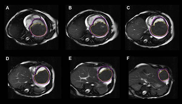 LV cine_short axis.tif LV cine_short axis.tif