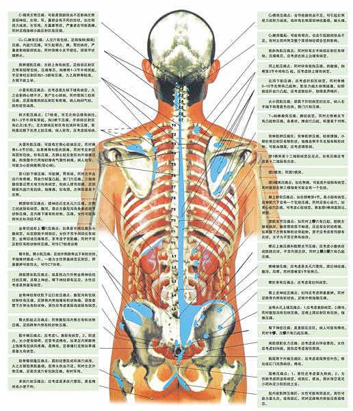 脊柱圖解－06－1脊柱相關疾病的脊背觸診診斷示意圖.jpg