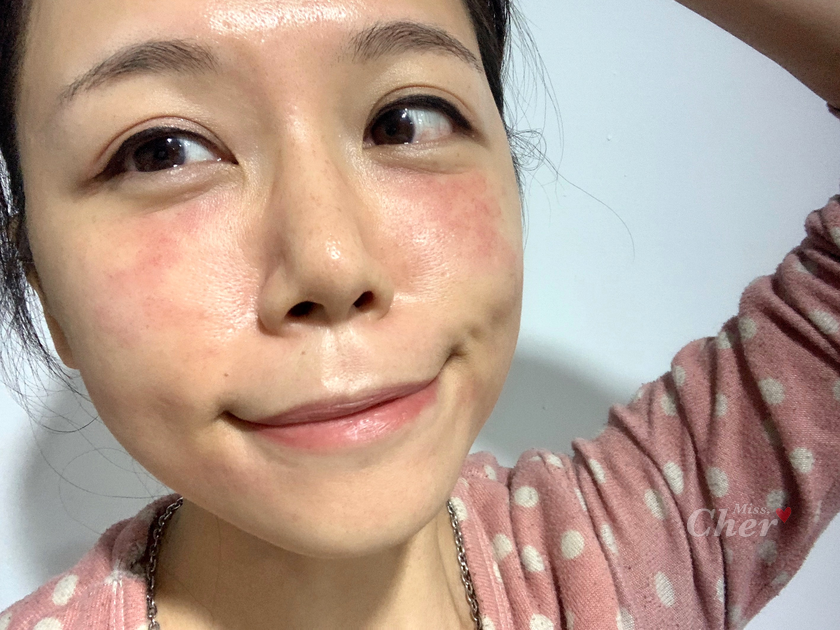 皮秒雷射體驗分享,皮秒雷射,皮秒,皮秒除斑,博恩妍