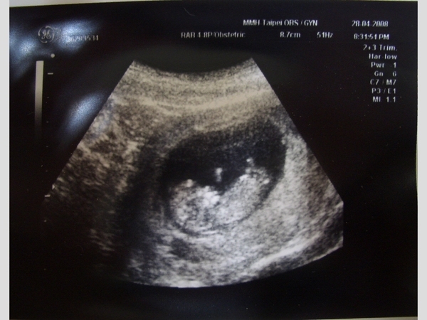 2008-4-26 (10weeks).JPG