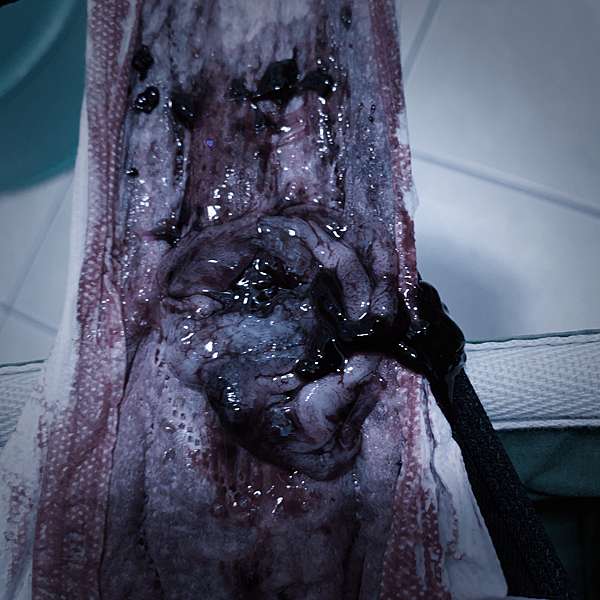 我懷孕了但也小產了 安胎心情紀實 櫻桃媽帶娃闖天涯 痞客邦