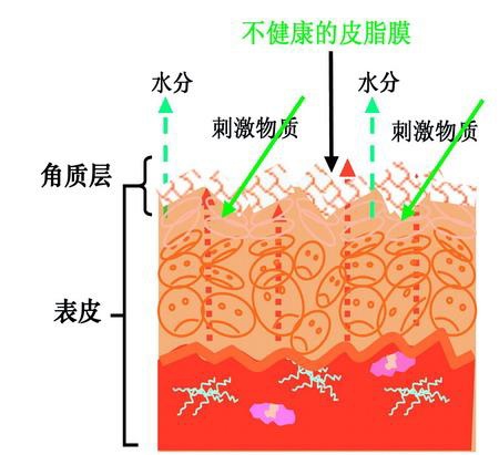 不健康肌膚