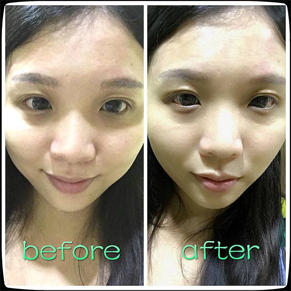 敷前敷後.jpg 試用