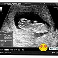 12W4D(2)(修)