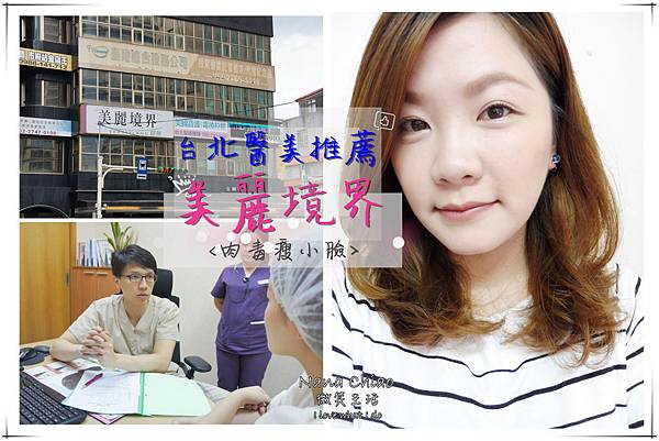 台北醫美-美麗境界診所-肉毒瘦小臉.jpg 台北醫美-美麗境界診所-肉毒瘦小臉.jpg