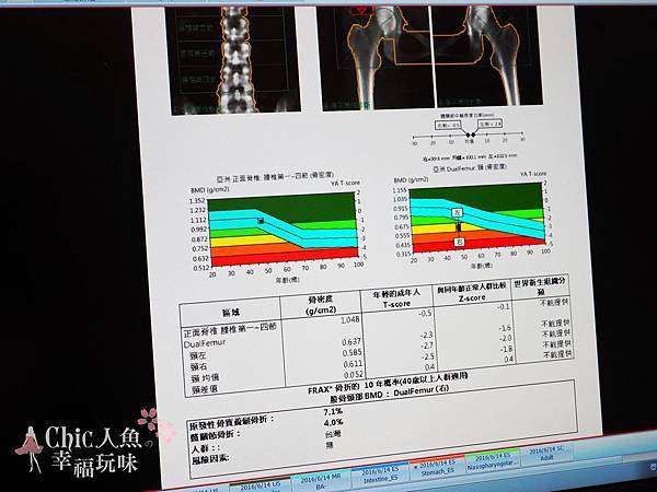 北投健康管理醫院 -常規報告當日解說 (5)