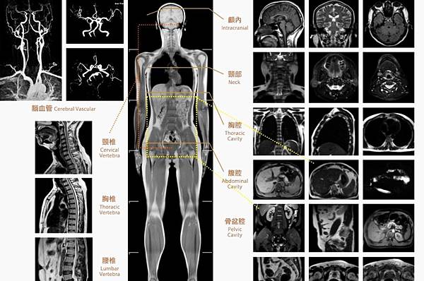 MRI檢測影像實例