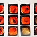 健檢書面報告-消化道 (4)