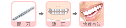 正顎手術002│高雄群英整形