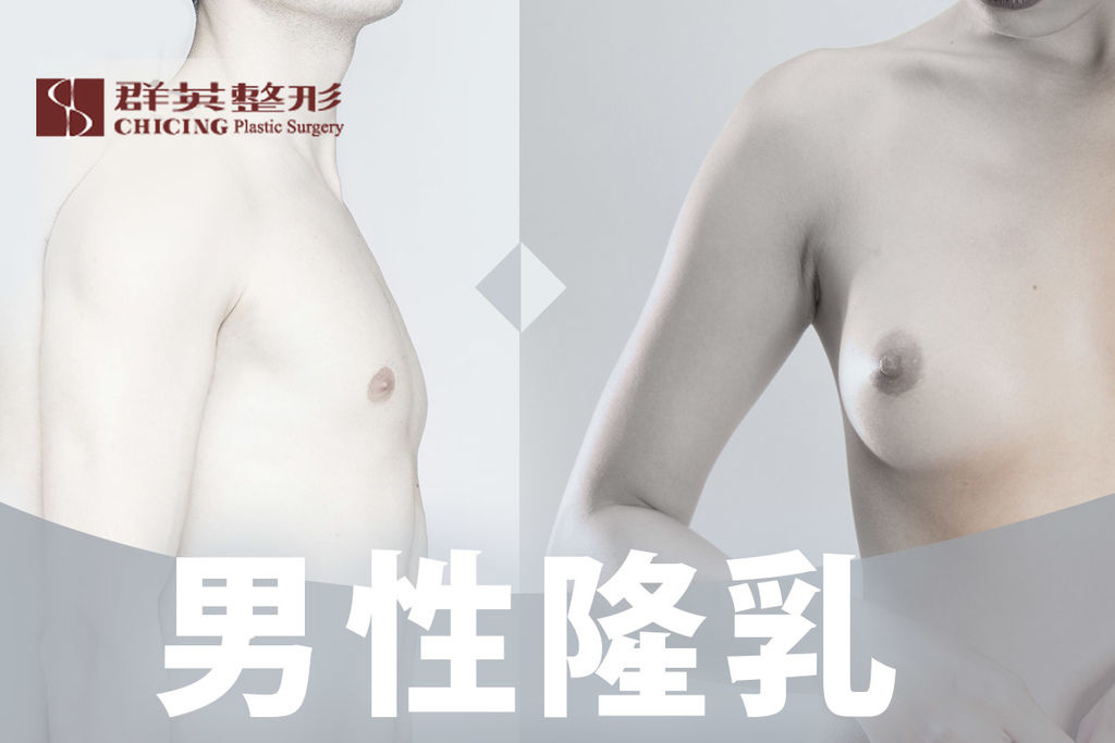 【高雄隆乳】男性隆乳有什麼不同？隆乳材質應該選擇什麼才好？｜高雄群英整形外科診所