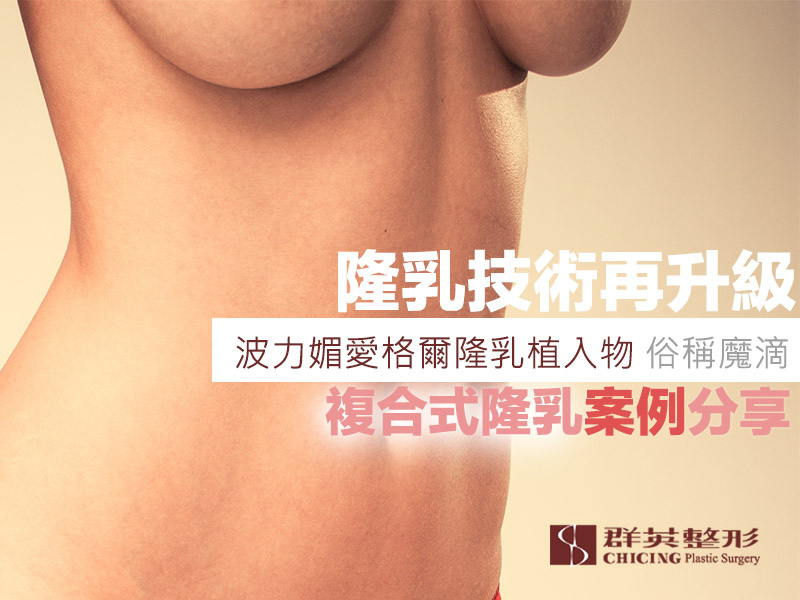 【高雄隆乳】隆乳技術再升級!波力媚愛格爾隆乳植入物(俗稱魔滴)複合式隆乳案例分享|高雄群英.jpg 複合式隆乳-波力媚愛格爾(魔滴)隆乳+補脂.jpg