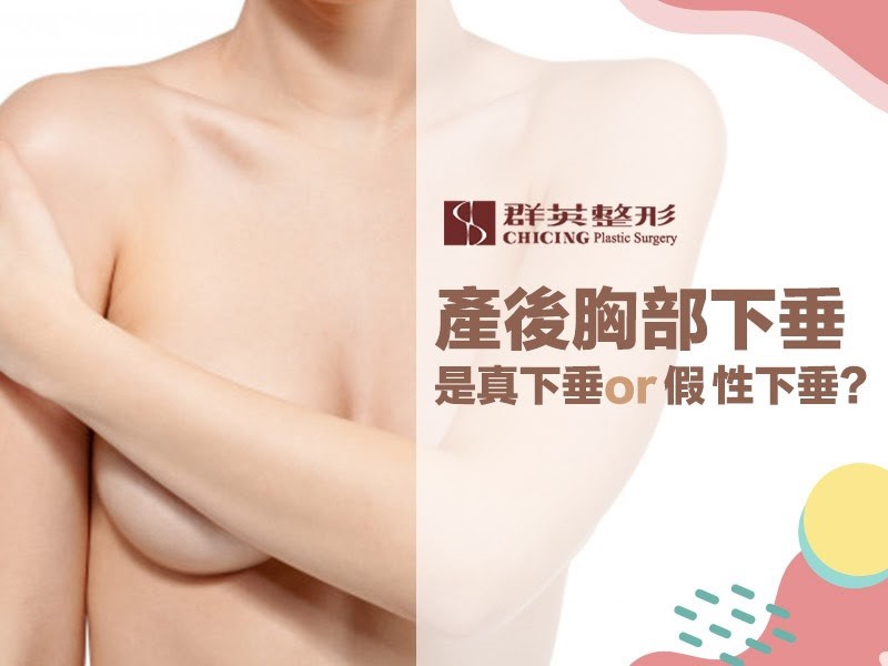 【高雄隆乳】產後胸部下垂,是真的下垂還是假性下垂?隆乳就能改善嗎?|高雄群英整形外科診所.jpg 高雄隆乳/高雄隆乳推薦/產後下垂/假性下垂/真下垂/隆乳手術/提乳手術/高雄姚勝發醫師/高雄謝禎祥醫師/改善產後下垂.jpg