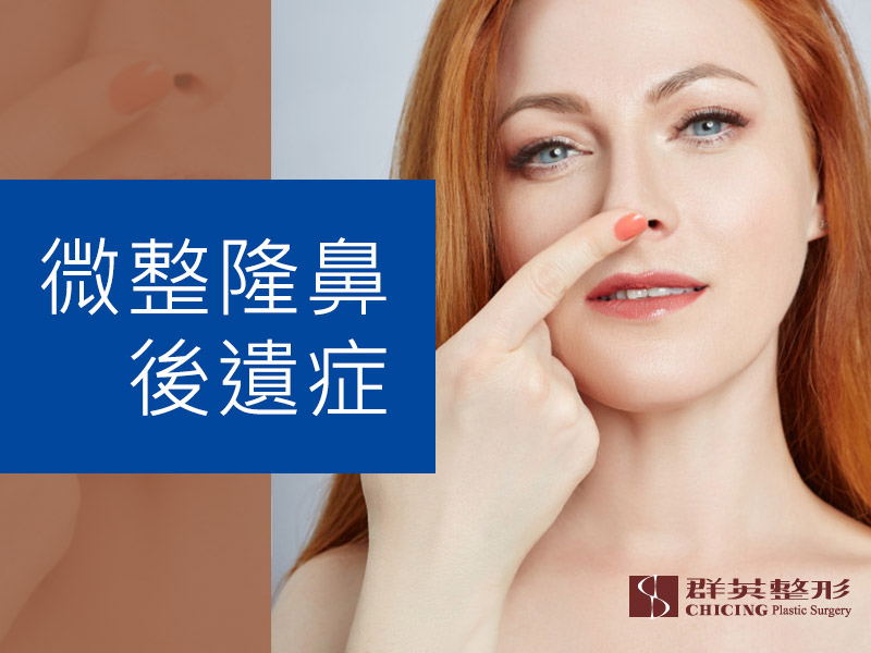 【高雄隆鼻推薦】了解微整隆鼻的後遺症-鼻子纖維化的原因及隆鼻手術的處理|高雄群英整形外科診所.jpg 高雄隆鼻/高雄隆鼻推薦/微整隆鼻/後遺症/微整隆鼻後遺症/纖維化/微晶瓷隆鼻/埋線隆鼻/隆鼻手術/高雄隆鼻醫師/高雄蘇毓彬/高雄隆鼻權威.jpg