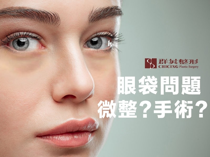 【眼袋手術】眼袋問題該微整還是手術？三種手術方式分析讓你知！｜高雄群英.jpg