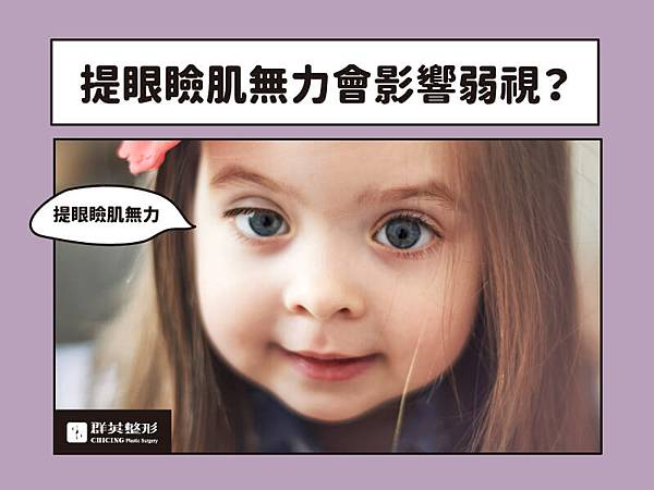 提眼瞼肌無力 提眼瞼肌無力