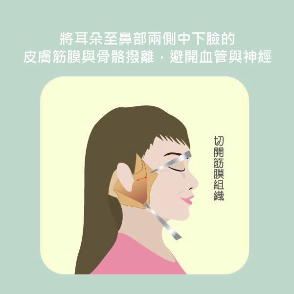 【台中拉皮】近位複合式拉皮手術,改善你的老化危機|台中群英整形外科診所.jpg 【台中拉皮】近位複合式拉皮手術,改善你的老化危機|台中群英整形外科診所.jpg