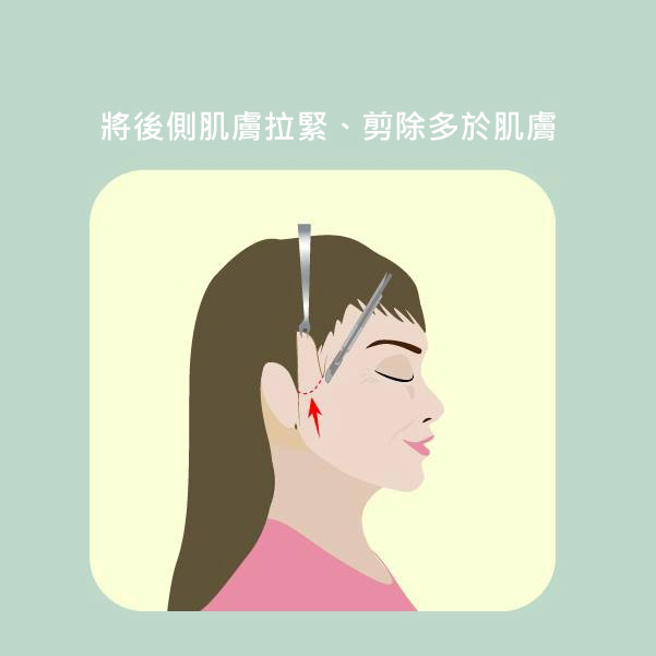 【台中拉皮】近位複合式拉皮手術,改善你的老化危機|台中群英整形外科診所.jpg 【台中拉皮】近位複合式拉皮手術,改善你的老化危機|台中群英整形外科診所.jpg