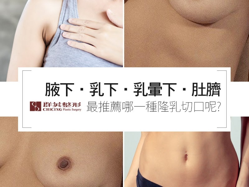 【台中隆乳】PTT鄉民共同疑問，腋下、乳下、乳暈下、肚臍，最推薦哪一種隆乳切口呢?｜台中群英整形外科診所.jpg