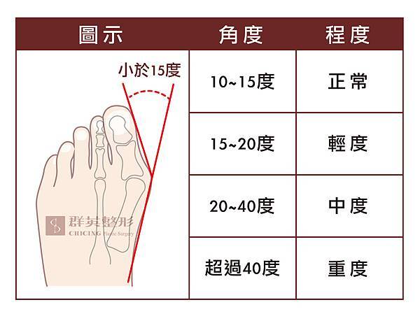拇指外翻-02.jpg 拇指外翻-02.jpg
