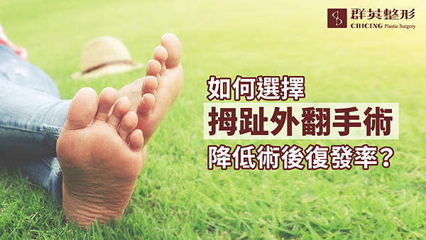 拇趾外翻手術 拇趾外翻手術