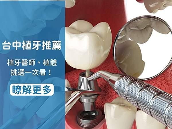 台中植牙推薦，亮齒植男劉家齊教你如何挑選植牙醫師，以及瞭解植
