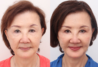 uho_news_033344 uho_news_033344