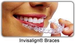 圖四invisalign braces